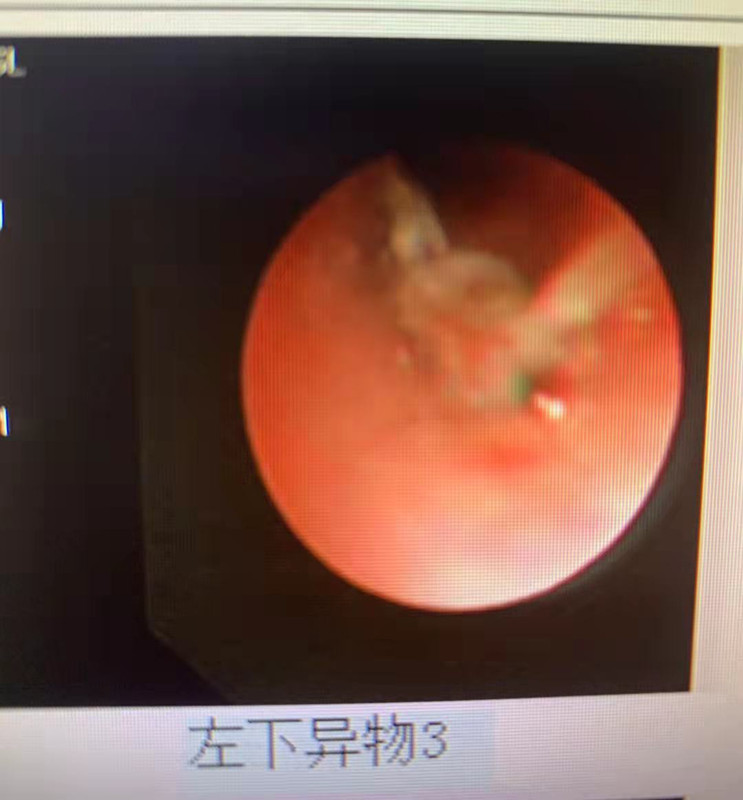 9de83a8cbdbd89c8c84daa9709c0547_副本.jpg
