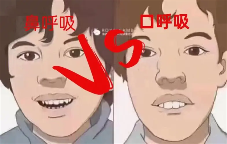 012.png