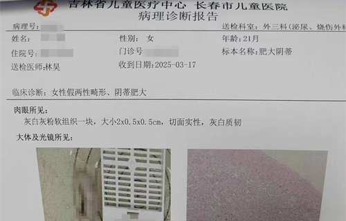首例“女性假两性畸形”治愈，德州扑克游戏网
又“上大分”！